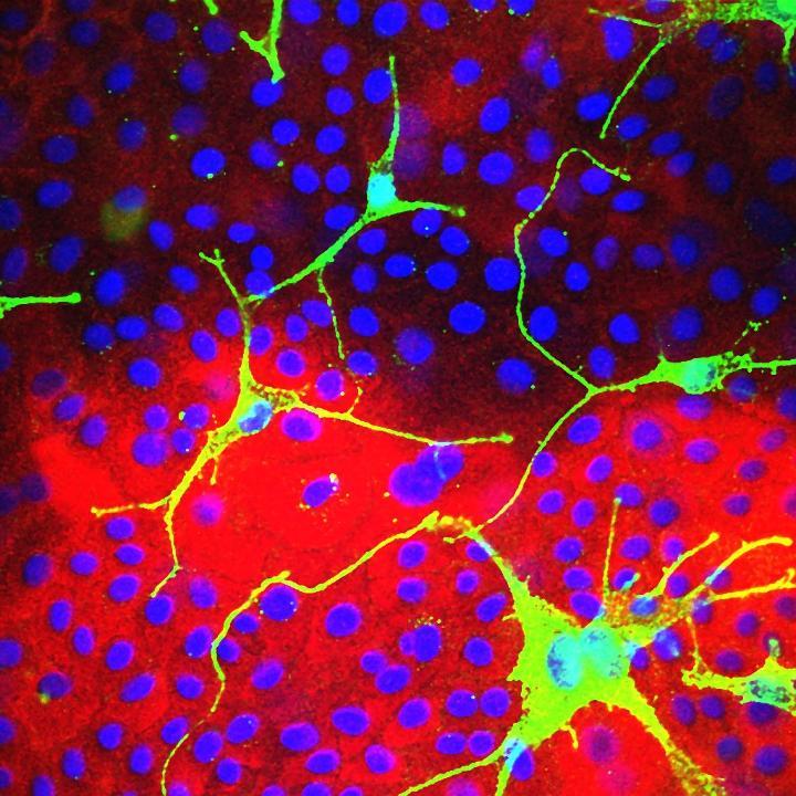 Melanocyte and keratinocyte co-culture showing melanin transfer