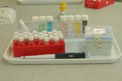 Drug screening bottles lined up in a row 